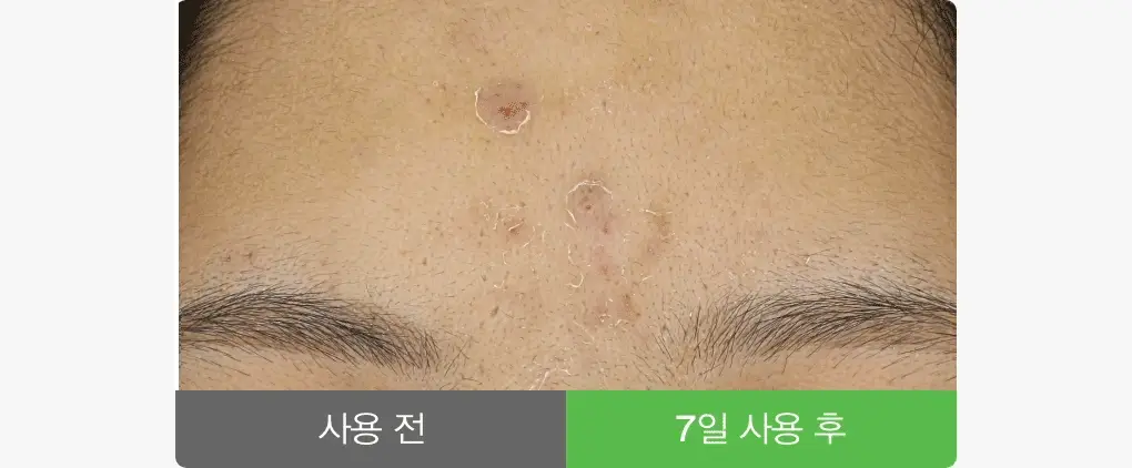 [5초진정세럼] 아비브 어성초 테카 캡슐 세럼 카밍 드롭 50ml 상세페이지 9